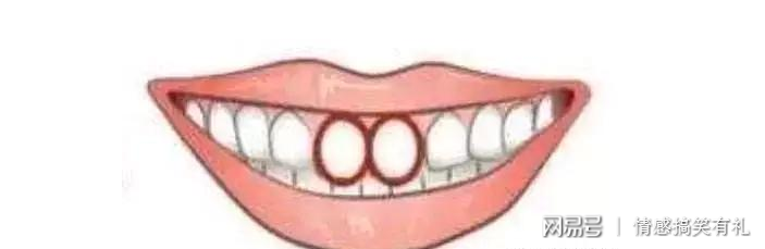 门牙的形状看出人的性格命运，4种情况，你属于哪一个？