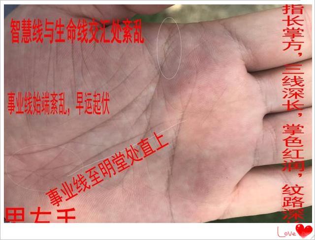 掌心有痣代表什么意思