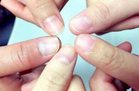 流言揭秘：手指甲的月牙能预示你的健康？
