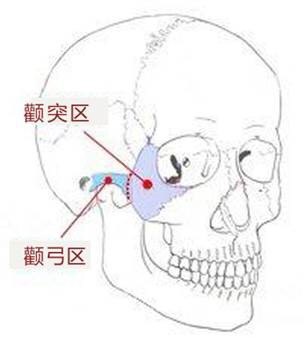 颧骨高克夫_颧骨高女人一定克夫么_女生颧骨高克夫吗