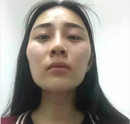 颧骨高女人一定克夫么_女生颧骨高克夫吗_颧骨高克夫