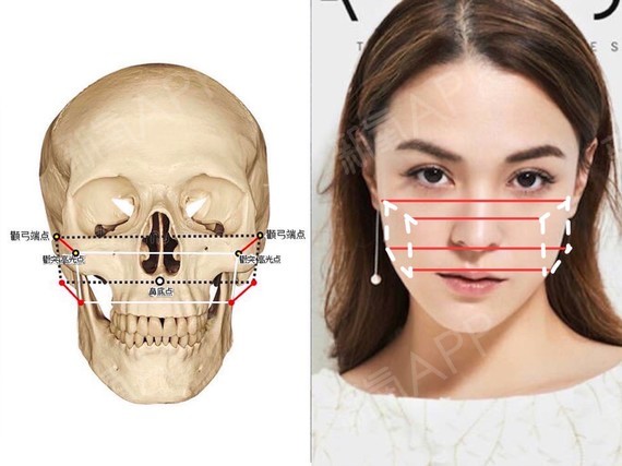 女生颧骨高克夫吗_颧骨高女人一定克夫么_颧骨高克夫