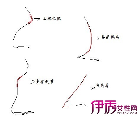 面相鼻子看相大全_鼻子相学图解鼻子看相_面相眼相大全,眼睛看相