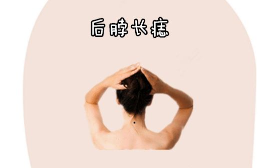 脖子后面有痣代表什么_男脖子前右边有痣代表_男人脖子后面右侧有痣