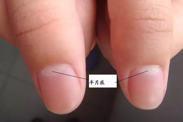 人手指甲上的月牙代表什么意思_指甲上的月牙代表什么生育能力吗_指甲月牙