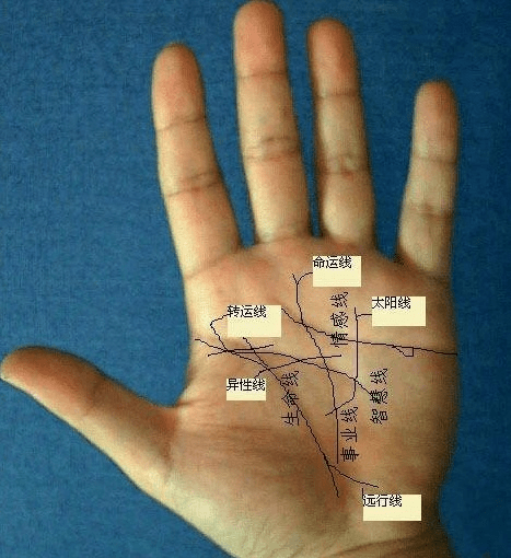手掌痣 示意图图片