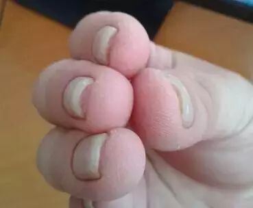 手指上的月牙_手指甲上的月牙_手指甲的月牙