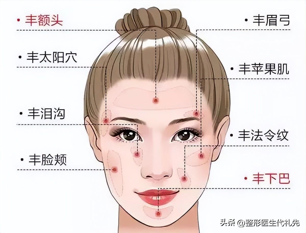 脂肪怎么填出骨感来？颧骨下沟应该怎么填充才能无下垂臃肿感？