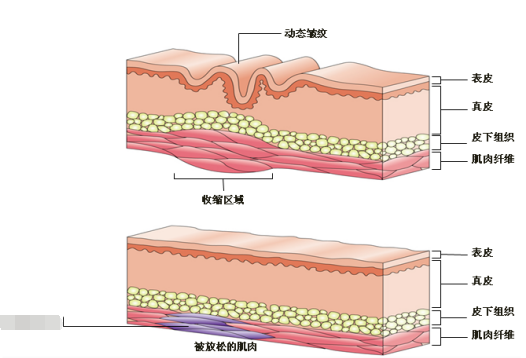 眉头皱纹是什么原因_眉头皱纹_眉头竖向皱纹