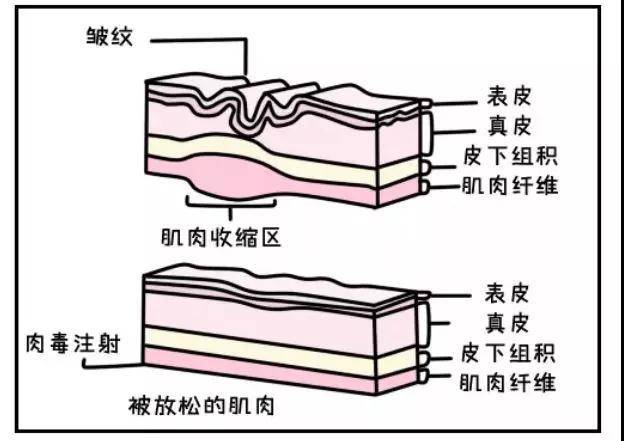 眉头皱纹两竖面相图解_眉头皱纹_眉头皱纹去除秘方