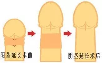 一个好方法：手指长短度看男人阴茎长度(图)