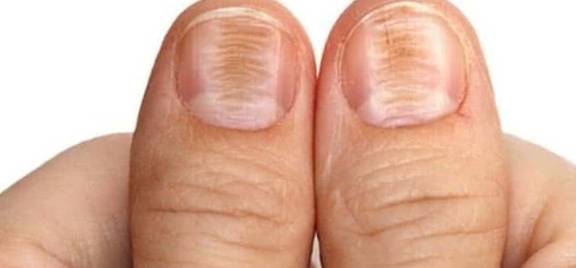为什么有的人手指甲很大，有的很小？