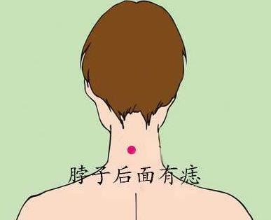 男人脖子后面有痣代表含义