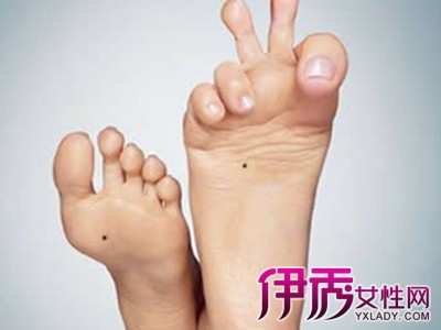 【图】右脚侧边有痣代表什么 揭露隐藏在你脚底的秘密