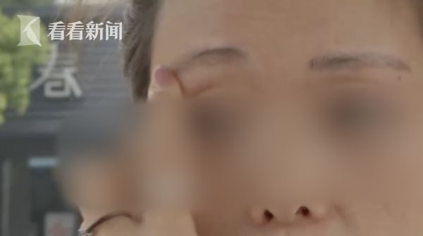 花6万纹“风水眉” 结果成了两把“大刀”？女子崩溃：不敢去上班