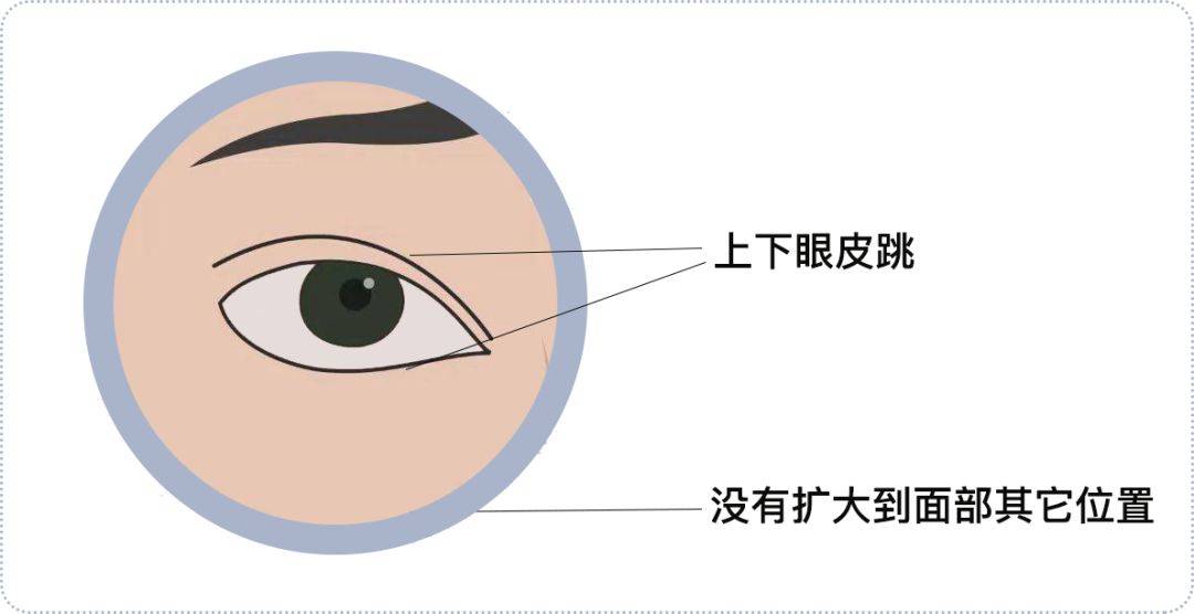 左眼皮跳跳，疾病要来到！谁说左跳福，右跳灾 有可能是病了呢！