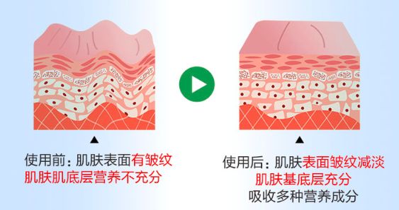 法令纹眉间纹又老又凶！睡前贴上它，胜过10次除皱针！