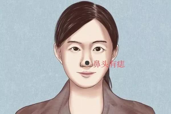 颈部痣相图解男人解说,男人眼痣图解大全